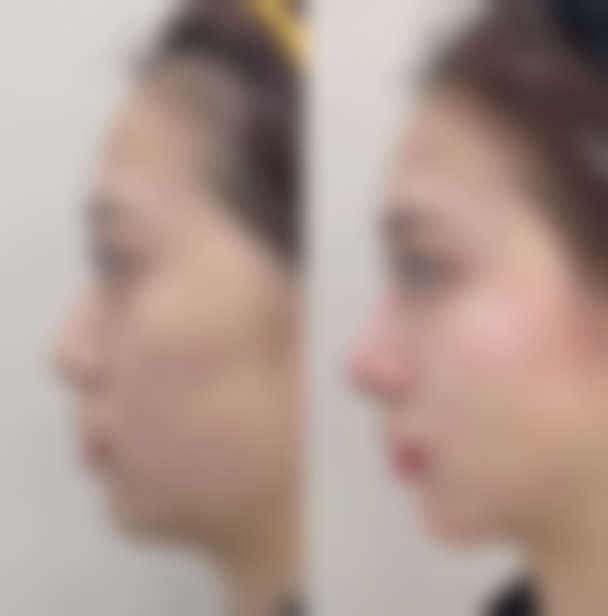 七、ARTLINE医院预约方式