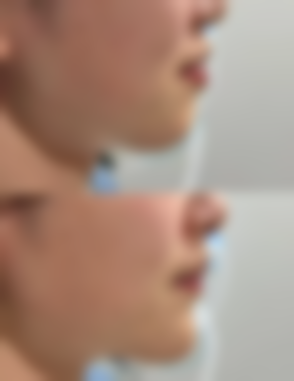 四、ARTLINE医院特色项目