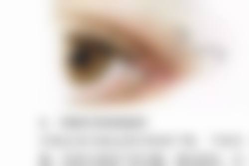 六、哪的双眼皮割的好之西安有医生生推荐