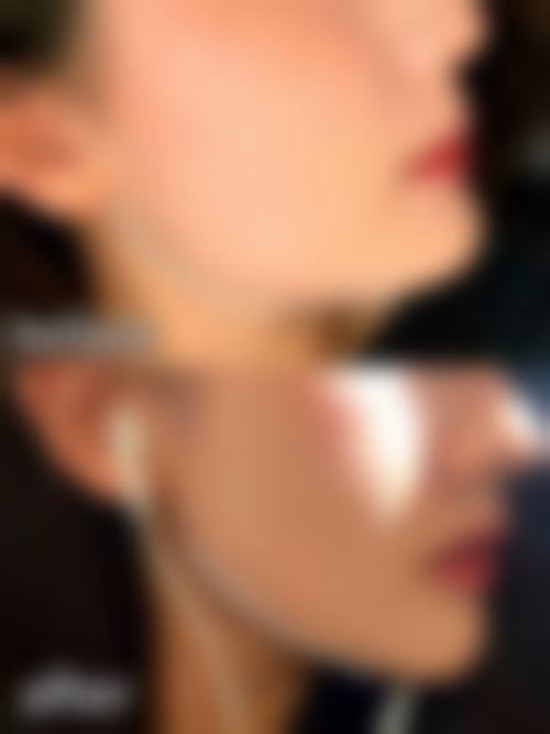 九、马鞍山瑞韩医疗美容诊所真实的患者评价