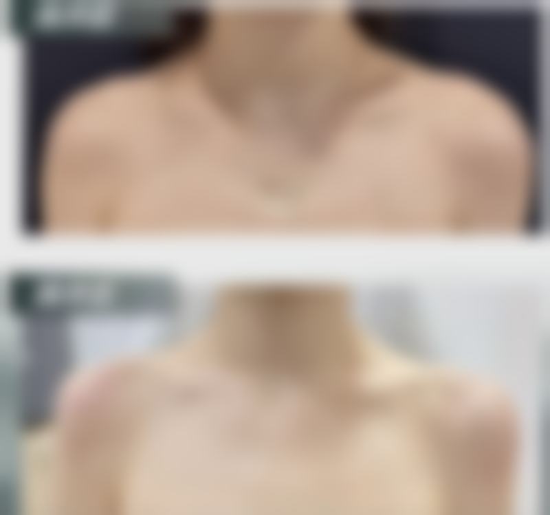 三、有什么方法可以让眼袋消失之日常注意事项