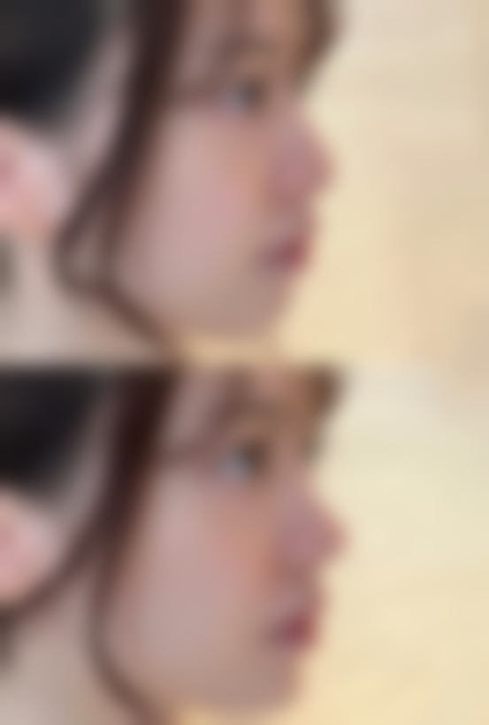 五、日常护理与预防