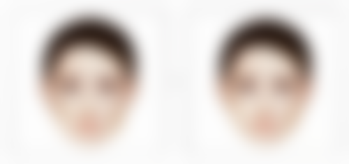 膨体生态隆鼻好不好？