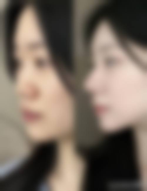 八、杭州占美整形医院预约方式