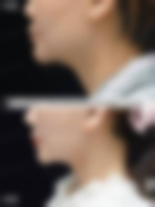 四、杭州占美整形医院特色项目