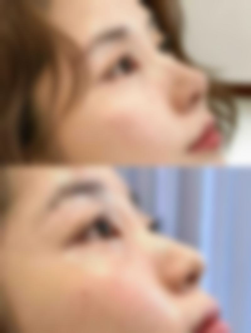 三、正确的按摩手法