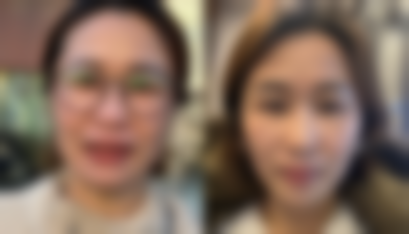 二、不同时间段的修复表现