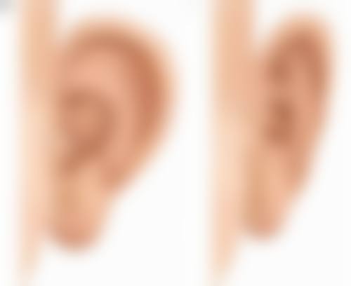 三、医美干预(需专精评估)