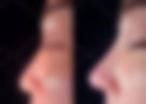 三、天津雅韵医疗美容门诊诊疗项目有哪些？