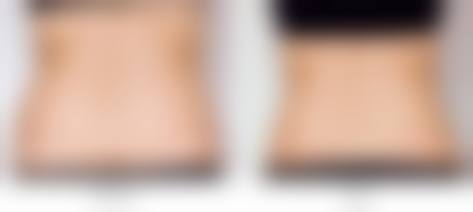 四、庆阳美立方医学美容诊所特色项目