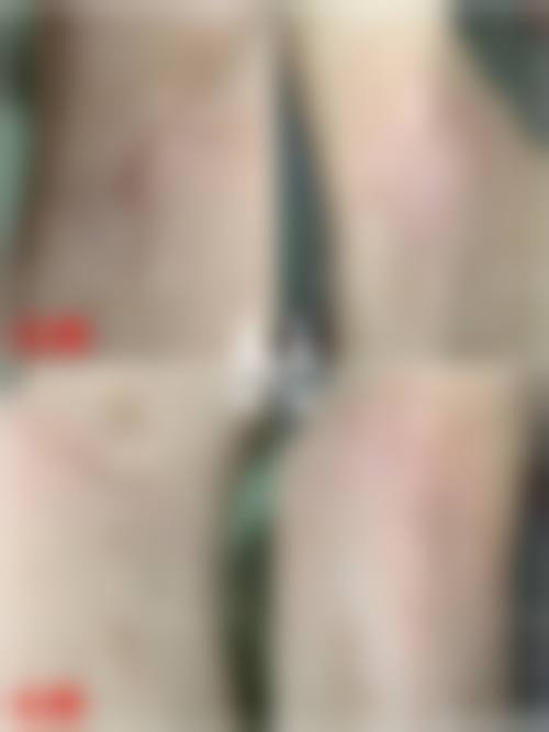 五、庆阳美立方医学美容诊所价格表