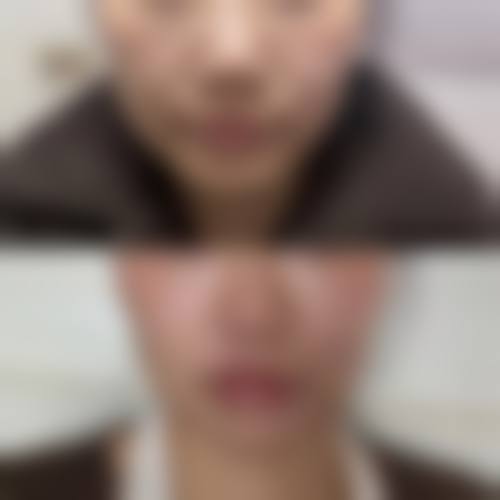 八、天津雅韵医疗美容门诊真实的患者评价