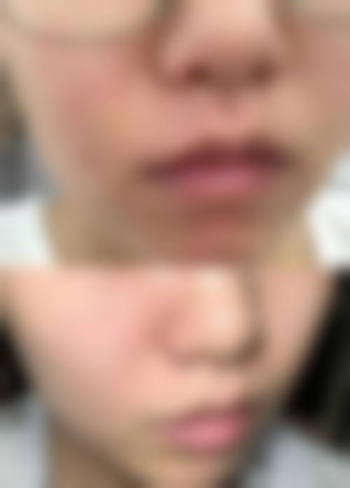 二、北京大媄一龄整形医院怎么样?