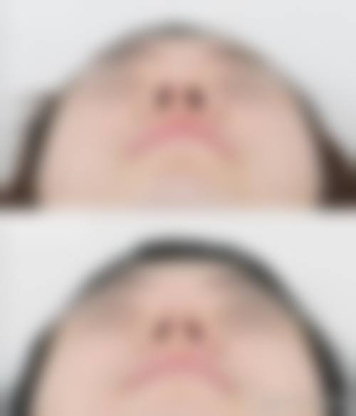 九、合肥好肤恒美医疗美容门诊部真实的患者评价