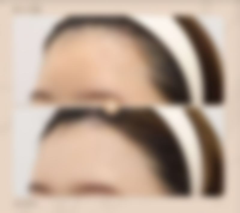 四、抓住黄金修复期