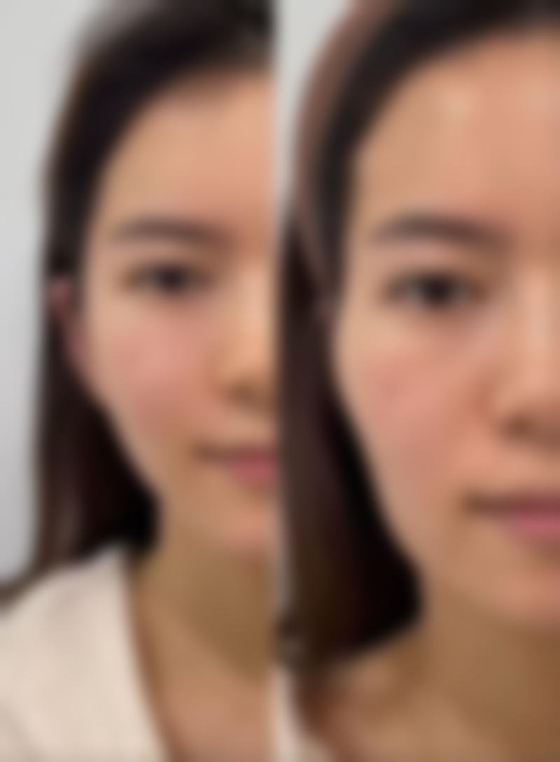 五、北京大媄一龄整形医院价格表