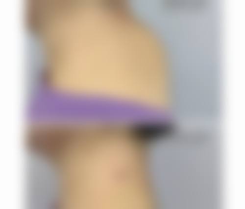 八、合肥洛菲医疗美容门诊部预约方式