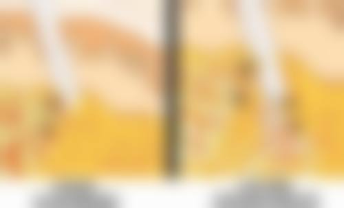 四、双眼皮形态设计与修复情况