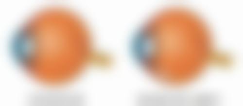 二、怎样去眼袋和皱纹：日常护理小妙招