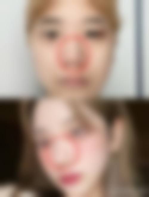 五、烟台臻颜颜 - 王玉珍美容整形外科价格表