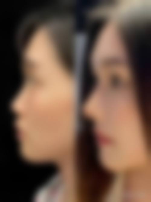 九、日本加藤美容整形医院真实的患者评价