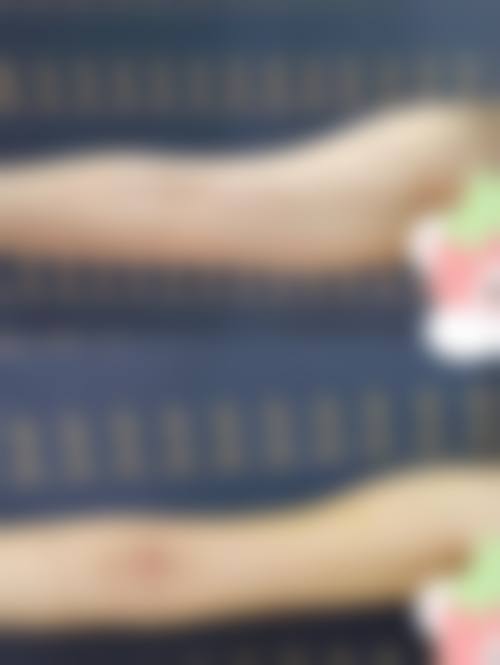 九、西安丽樽医疗整形美容真实的患者评价