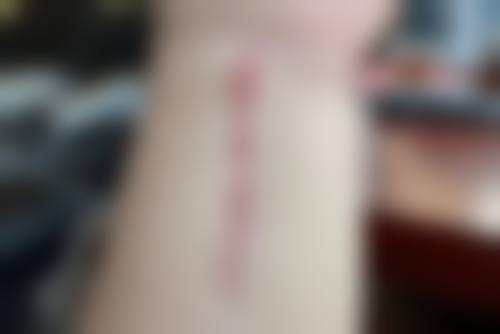 六、合肥洛菲医疗美容门诊部价格表