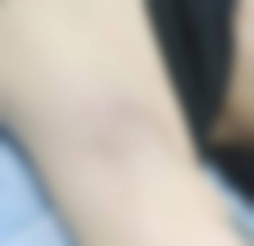 三、刘晓燕技术优势