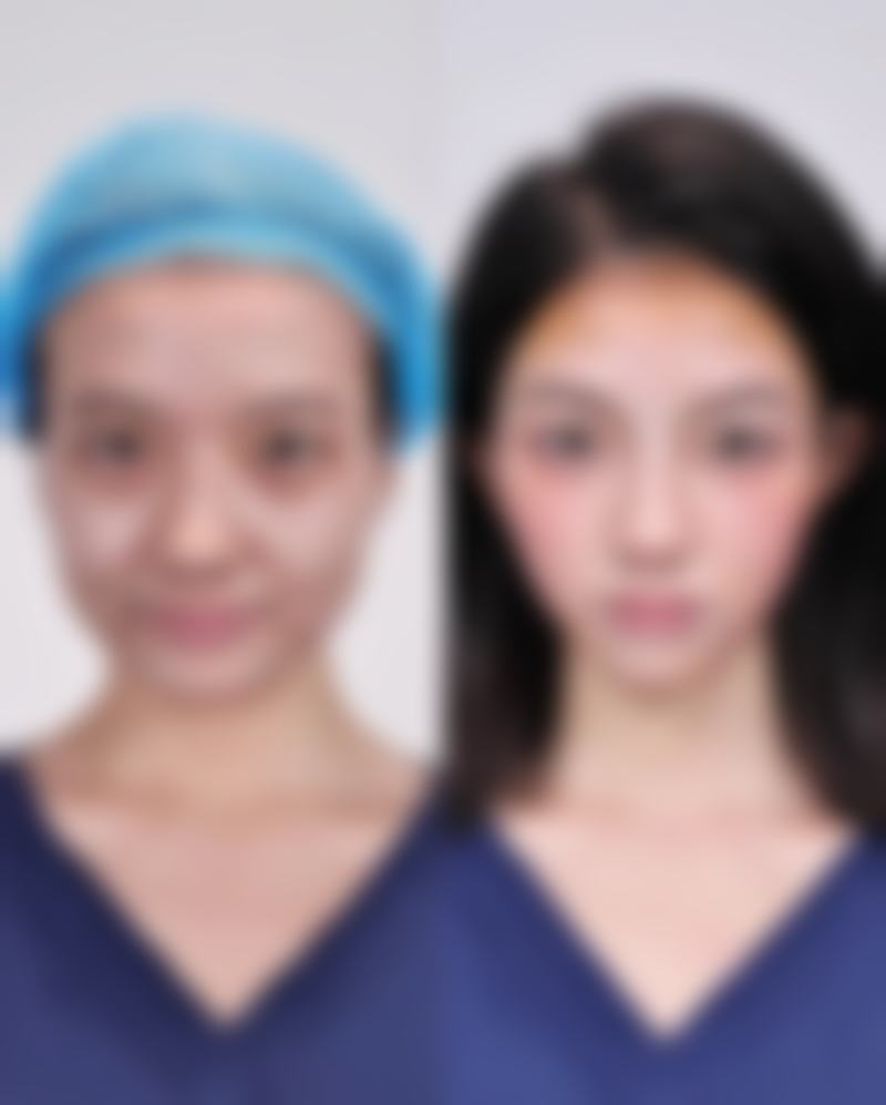 二、正常修复与异常情况对照，判断是否需就医