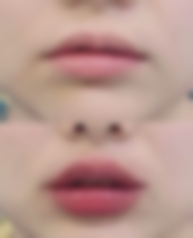 六、修复手术的时机