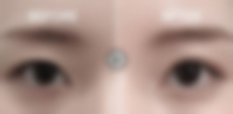 一、了解眼袋成因，为消除眼袋打基础