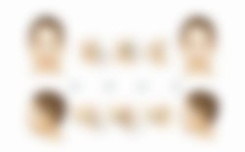 四、术后修复各阶段的其他注意事项