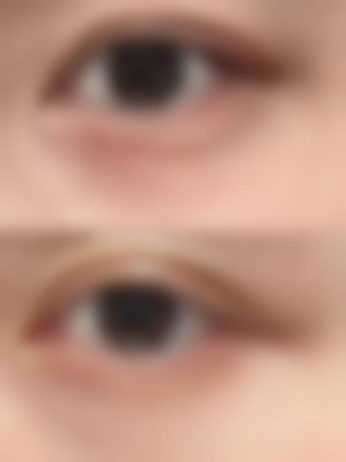 四、西宁集享整形医院特色项目