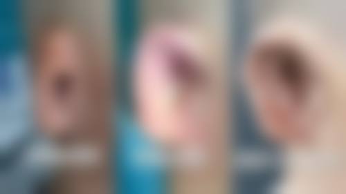 二、西宁集享整形医院怎么样？