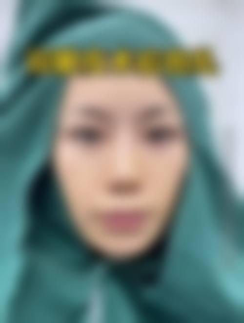 六、合肥禾丽医美价格表