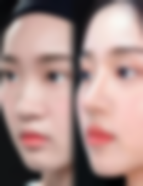 二、杭州嘉芸整形医院怎么样？