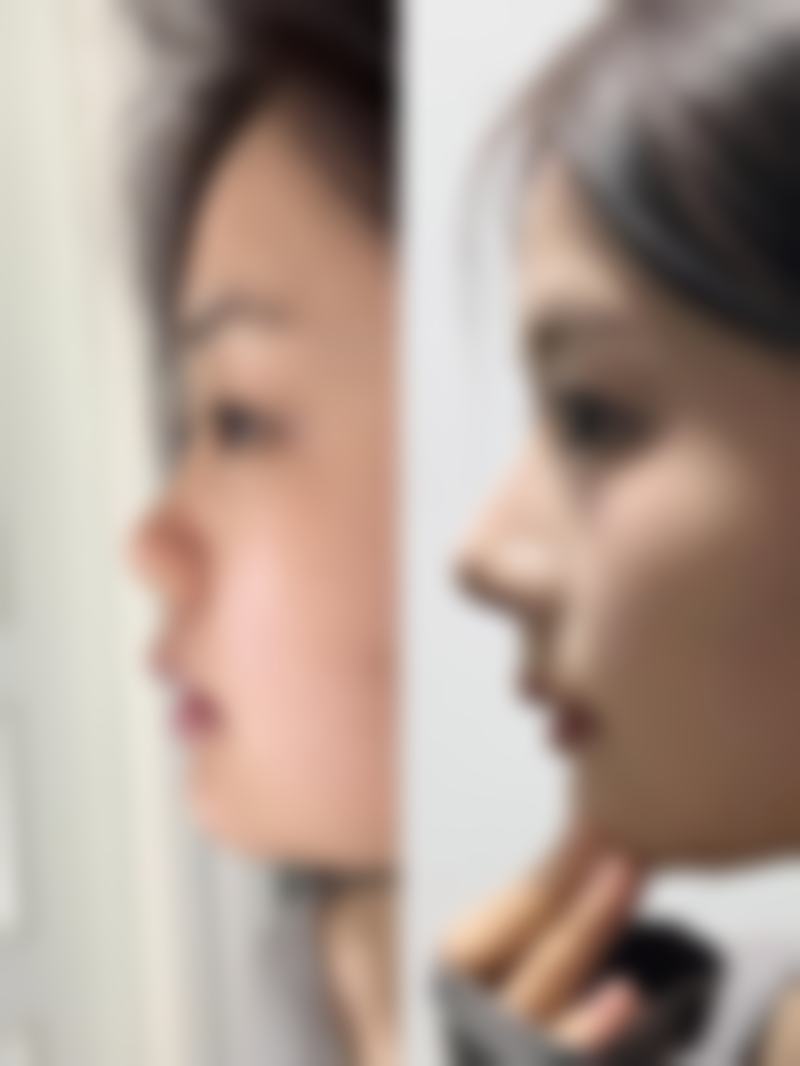 九、杭州嘉芸整形医院真实的患者评价