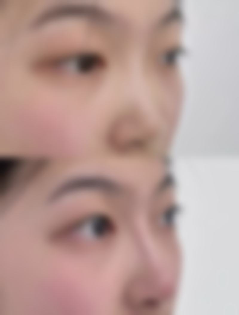 五、理性看待修复可能性