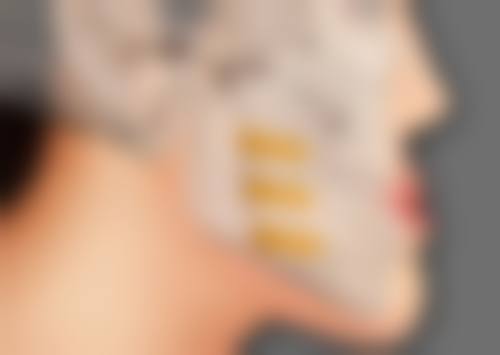 瘦脸针多久看得出效果？了解显效时间、影响因素及护理要点很重要！ 