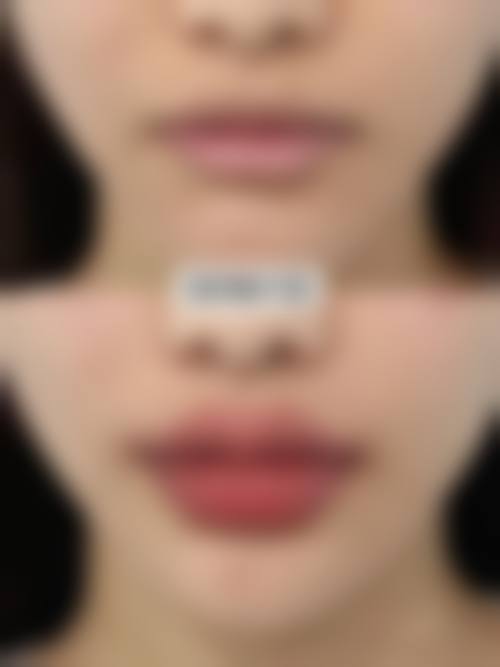 八、云南爱美汇医疗美容诊所预约方式