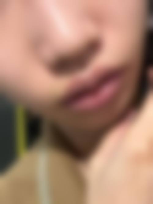 二、云南爱美汇医疗美容诊所怎么样？