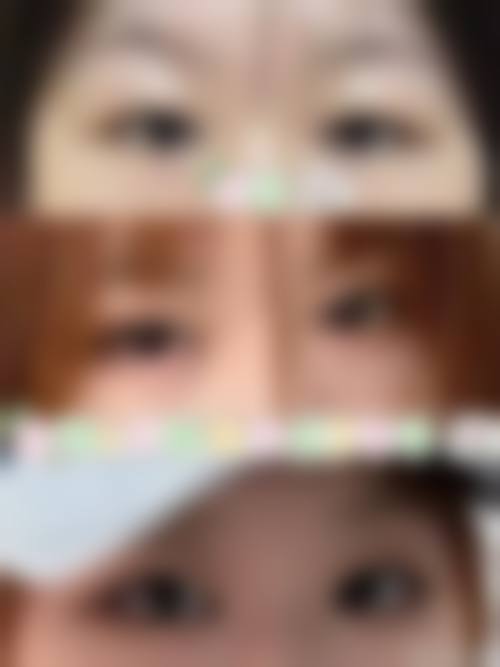 八、衢州桂美人医疗美容门诊真实的患者评价