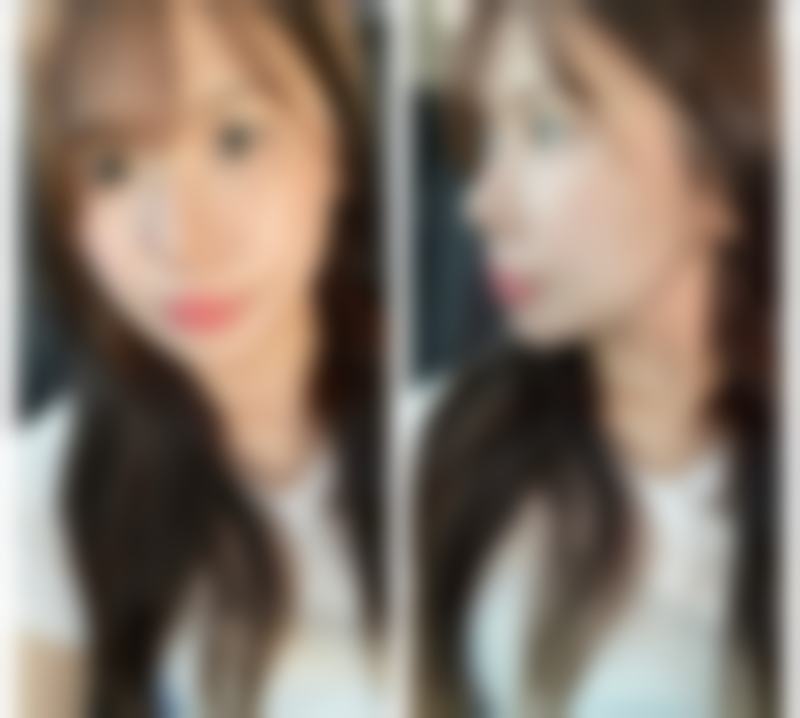 四、不同手术方式的成效维持与修复期