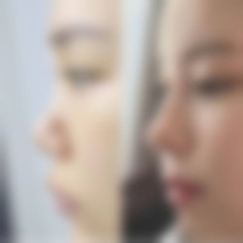 八、北京天琦医疗美容诊所真实的患者评价