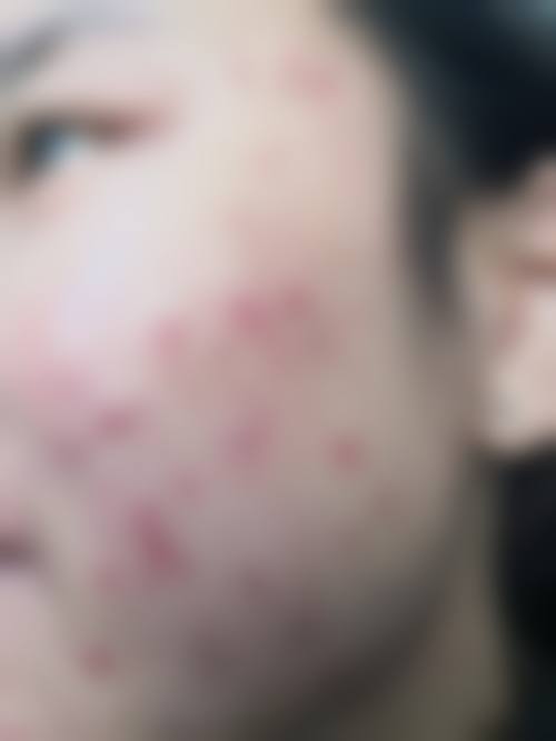 三、莫利香技术优势