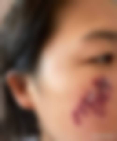 四、重庆凤冠医疗美容特色项目