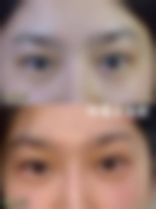 四、益阳爱思特医疗美容医院有限公司特色项目