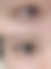 五、重庆凤冠医疗美容价格表