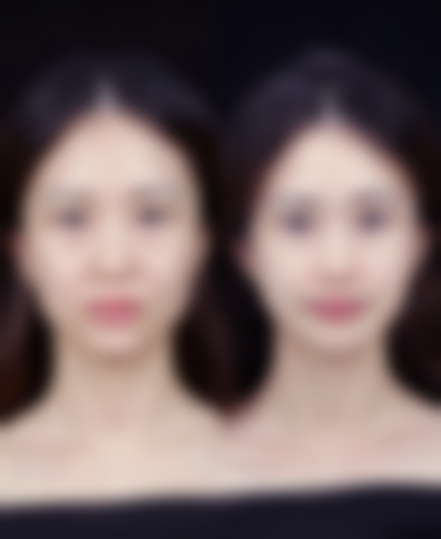 四、莫利香收费价格表