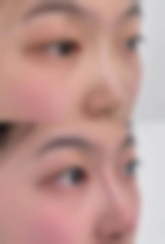 一、疤痕修复时间的总体情况